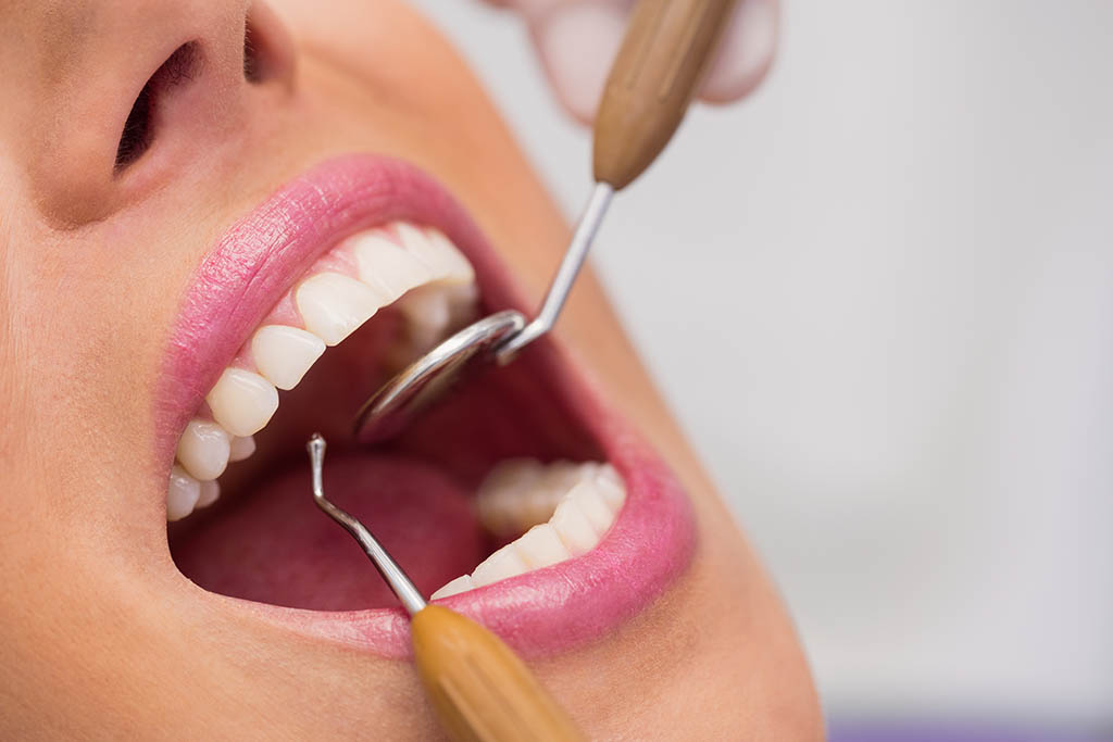 箍牙前要由註冊牙醫直接會面檢查口腔狀況