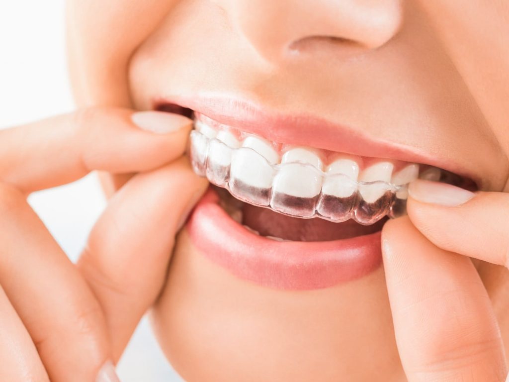 歯並びを整える方法